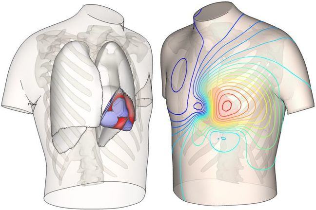 Snapshot of simulated cardiac electrical activity in two bodies
